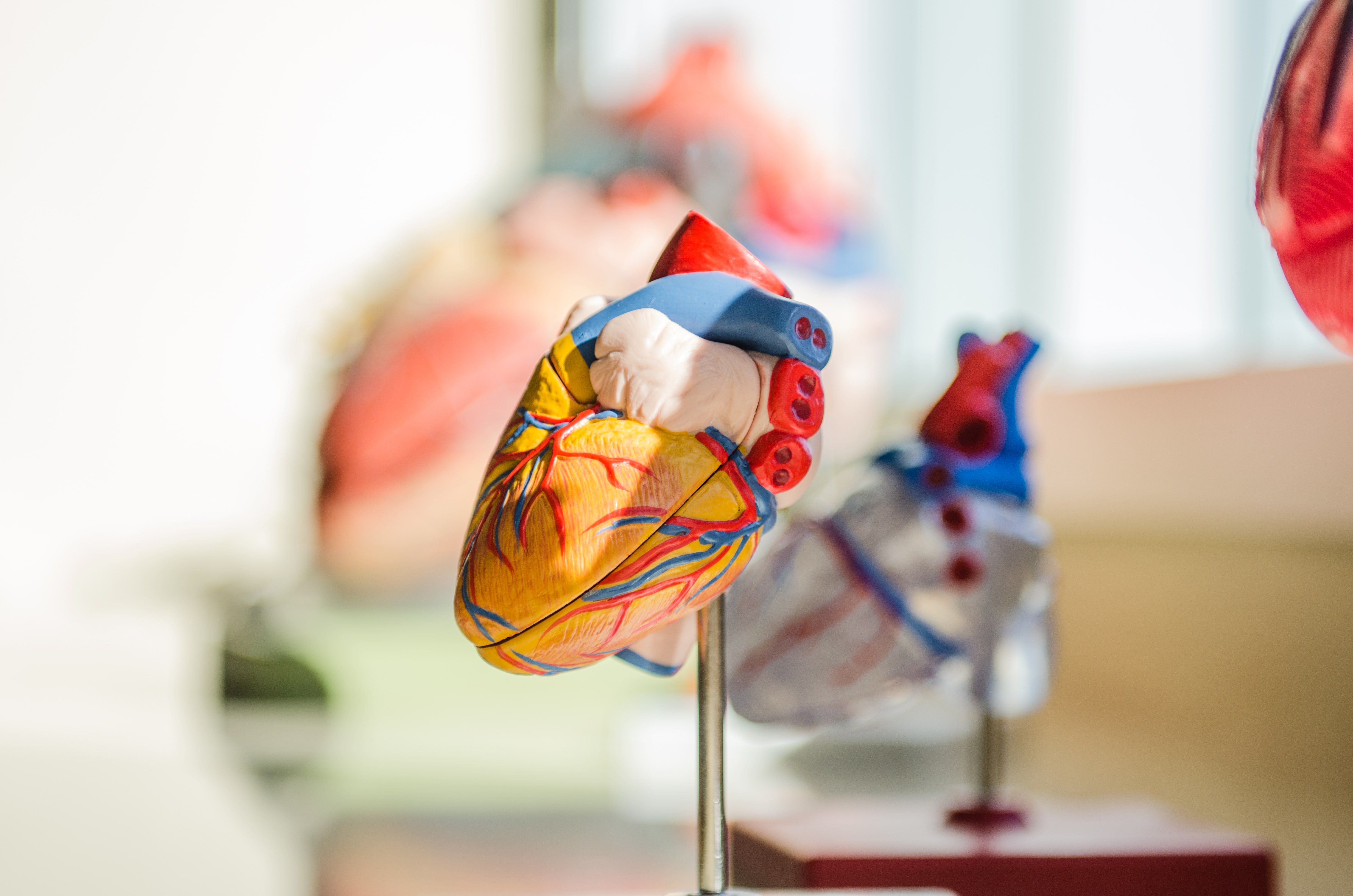 3D Medical Lab is een innovatief Utrechts bedrijf dat wordt geleid door Technisch Geneeskundige. In het figuur is een aortaboog dissectie weergegeven.